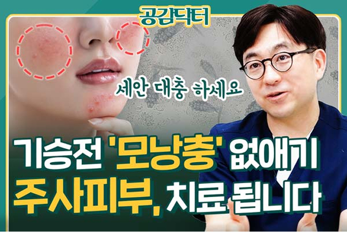 홍조, 여드름과 다른 주사피부 ‘이 것’ 제거하면 치료 됩니다