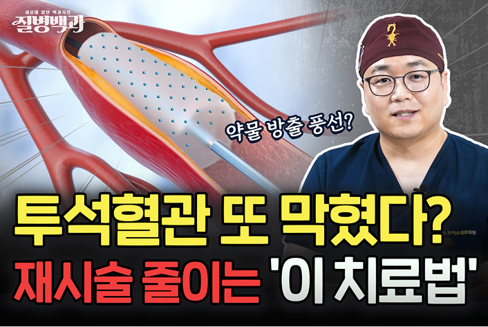 투석혈관 또 막혔다면? 재시술 빈도 줄이는 ‘이 치료법’
