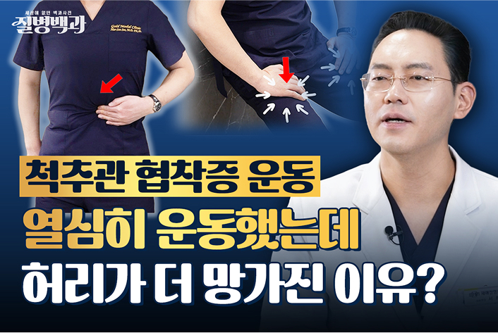 척추관 협착증, 걷기 힘든 소극증 유발? 이 운동이 답