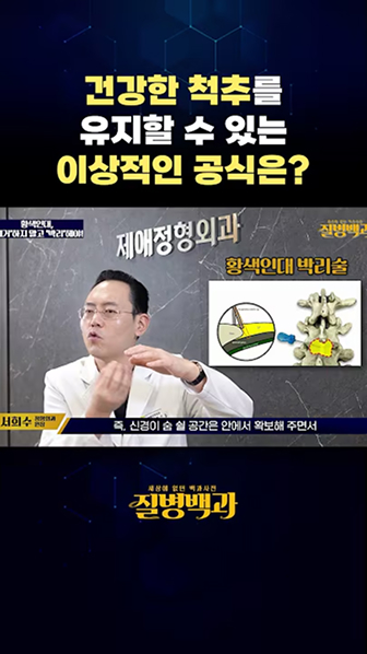 건강한 척추를 유지할 수 있는 이상적인 공식은?