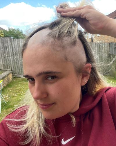 의사는 정신질환 의심했는데… AI 덕에 희귀병 발견한 20대 女