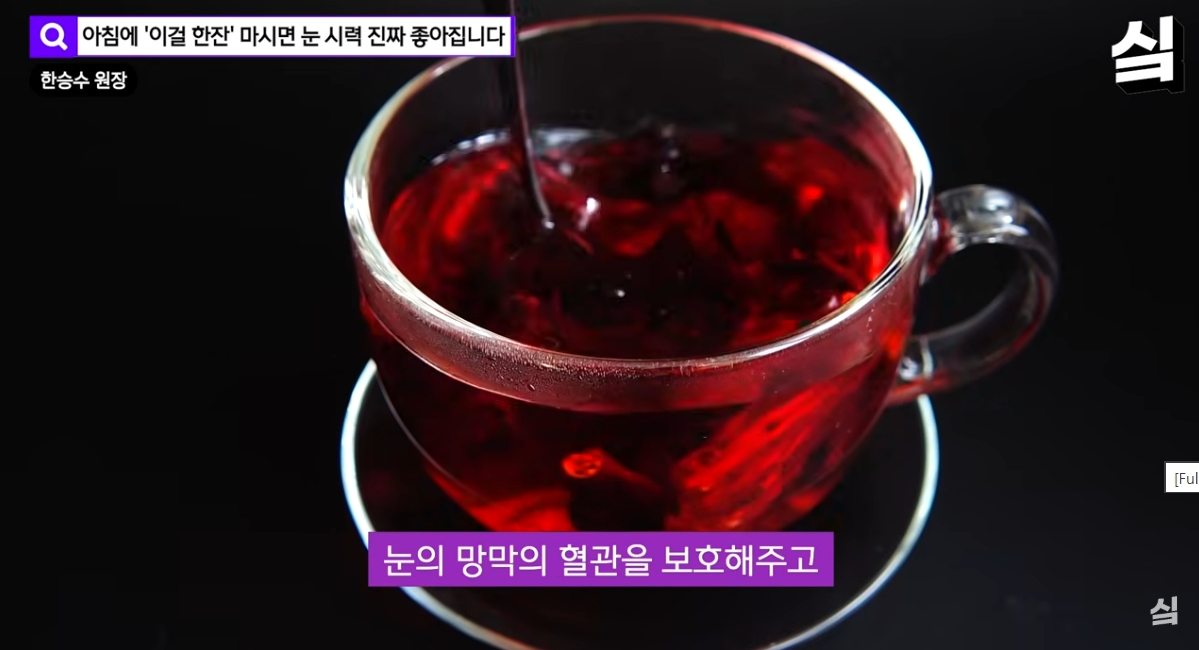 눈 건강 및 안과 진료 관련 이미지