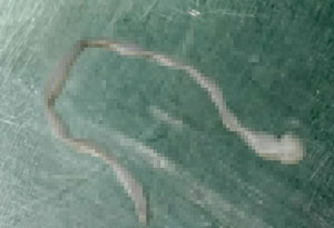 뇌에서 발견된 기생충 관련 보도 이미지