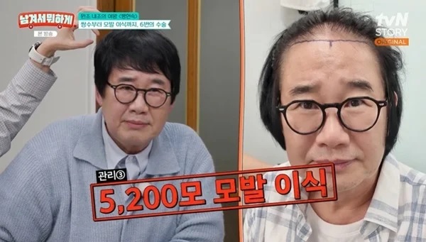 tvN STORY 방송 관련 보도 이미지 - 최양락