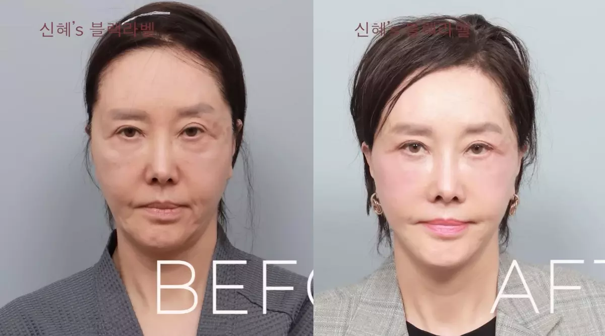 이미지